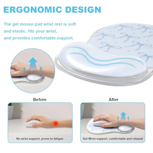 Blue Bow Mouse Pad with Gel Wrist Rest Support - Ergonomic Cooling Mousepad Support with Non-Slip Base for Computer/Office/Home - color: Blue Bow