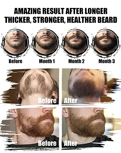 Beard Kit for Men Grooming & Care: Christmas Stocking Stuffers Valentines Fathers Birthday Gifts for Men, Husband, Dad, Boyfriend with Sandalwood Beard Oils and Balm, Wash & Conditioner, Brush, Comb