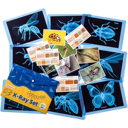 Insect Xrays – Bug Science Kit - Light Table Accessories | Bug Detectives for Kids, STEM Learning Insect X-Ray Set - style: Insect Series
